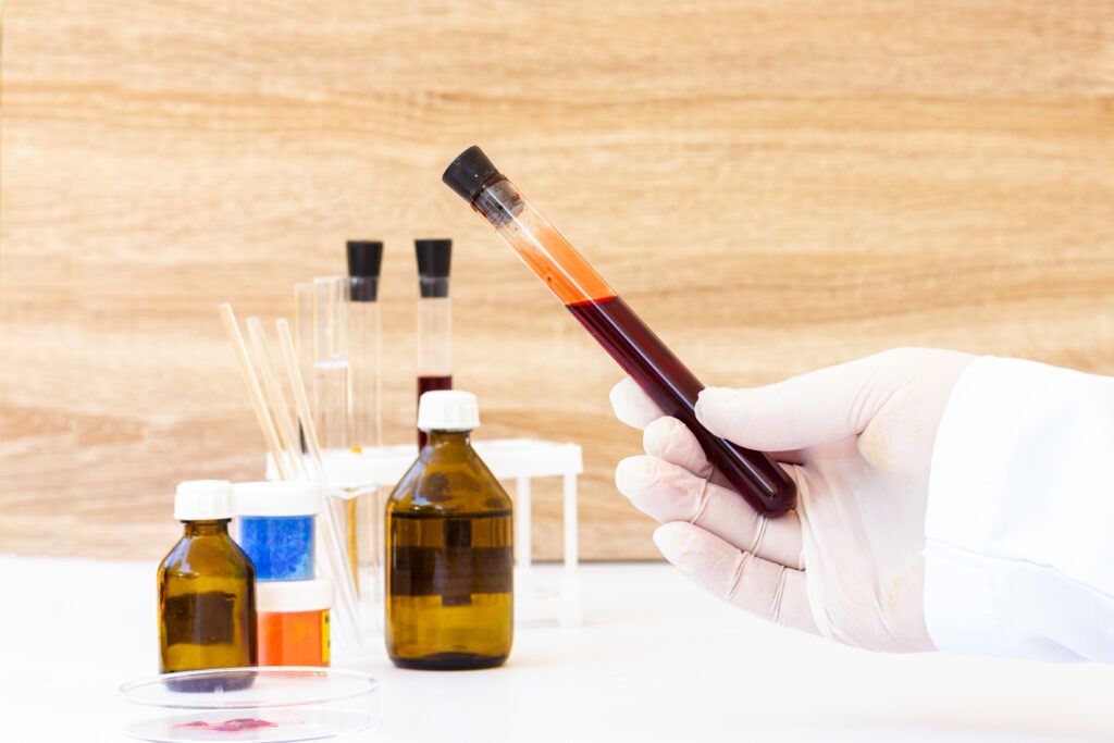 blood and urine test senawang